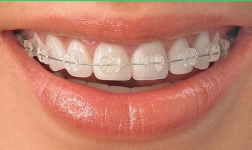 Bệnh viện nha khoa uy tín TPHCM có đáp ứng hết nhu cầu làm răng hiện nay không?